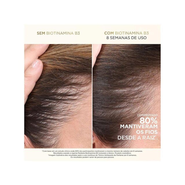 Condicionador Pantene Pro-V Miracles Biotinamina B3 Antiqueda & Nutrição 250ml